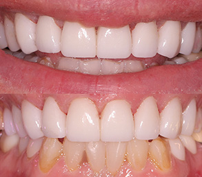 Smile Gallery - After