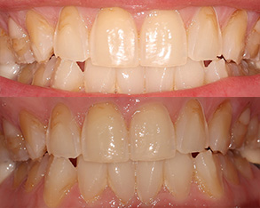 Smile Gallery - Before